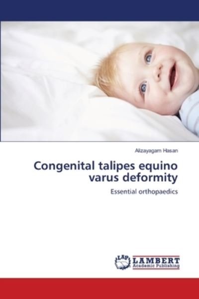 Congenital talipes equino varus d - Hasan - Books -  - 9786139829453 - May 2, 2018