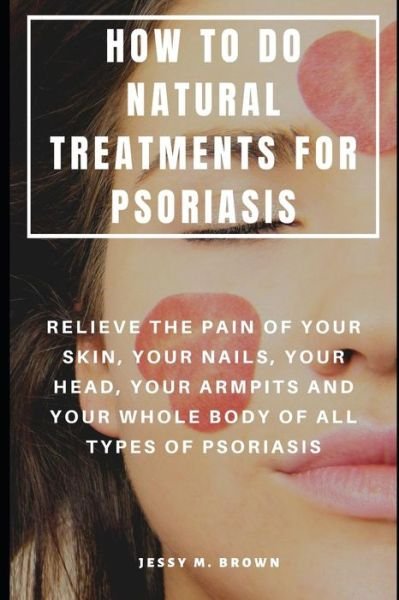 Cover for Jessy M Brown · How to Do Natural Treatments for Psoriasis (Taschenbuch) (2019)