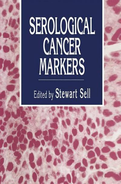 Cover for Stewart Sell · Serological Cancer Markers - Contemporary Biomedicine (Paperback Book) [Softcover reprint of the original 1st ed. 1992 edition] (2012)