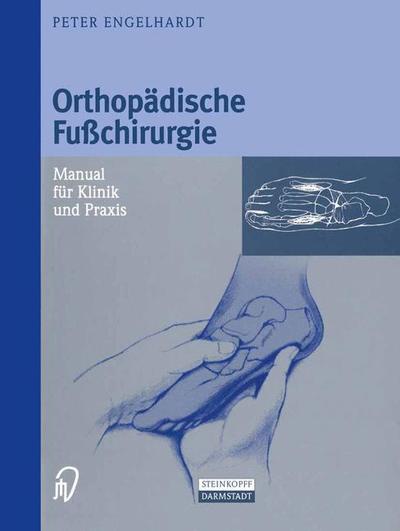 Cover for Peter Engelhardt · Orthopadische Fuchirurgie: Manual fur Klinik und Praxis (Paperback Book)