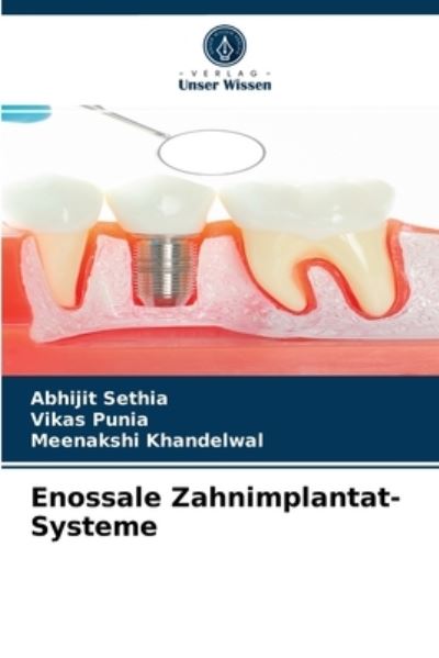Cover for Abhijit Sethia · Enossale Zahnimplantat-Systeme (Paperback Book) (2021)