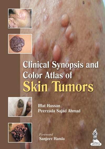 Cover for Iffat Hassan · Clinical Synopsis and Color Atlas of Skin Tumors (Paperback Book) (2013)