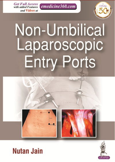 Cover for Nutan Jain · Non-Umbilical Laparoscopic Entry Ports (Hardcover Book) (2020)