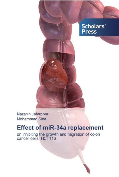 Cover for Nazanin Jafarpour · Effect of miR-34a replacement (Pocketbok) (2019)