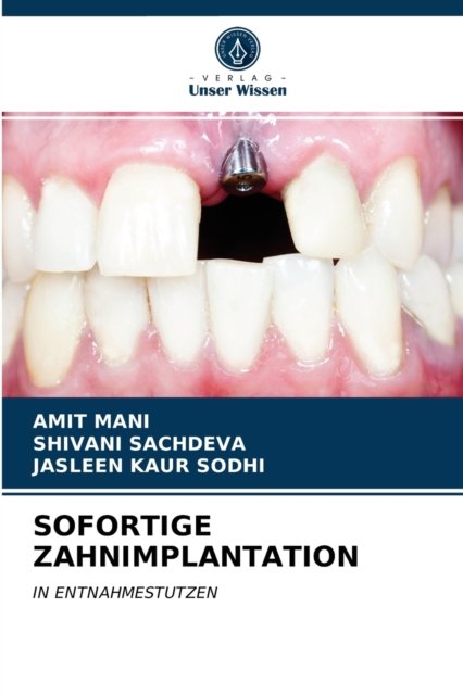 Cover for Mani · Sofortige Zahnimplantation (N/A) (2021)