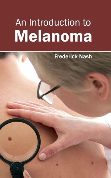 Cover for Frederick Nash · An Introduction to Melanoma (Gebundenes Buch) (2015)