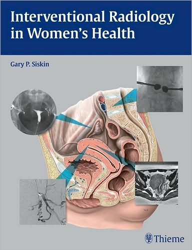 Interventional Radiology in Women's Health - Gary P. Siskin - Libros - Thieme Medical Publishers Inc - 9781604060461 - 5 de mayo de 2009