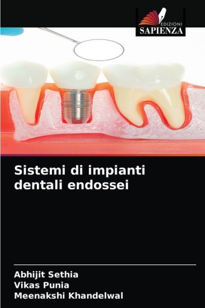 Cover for Abhijit Sethia · Sistemi di impianti dentali endossei (Paperback Book) (2021)