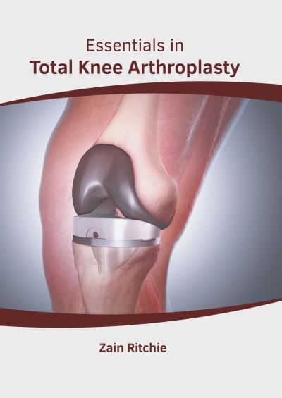 Cover for Zain Ritchie · Essentials in Total Knee Arthroplasty (Hardcover Book) (2022)