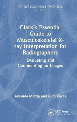 Cover for Amanda Martin · Clark’s Essential Guide to Musculoskeletal X-ray Interpretation for Radiographers: Evaluating and Commenting on Images - Clark's Companion Essential Guides (Hardcover Book) (2025)