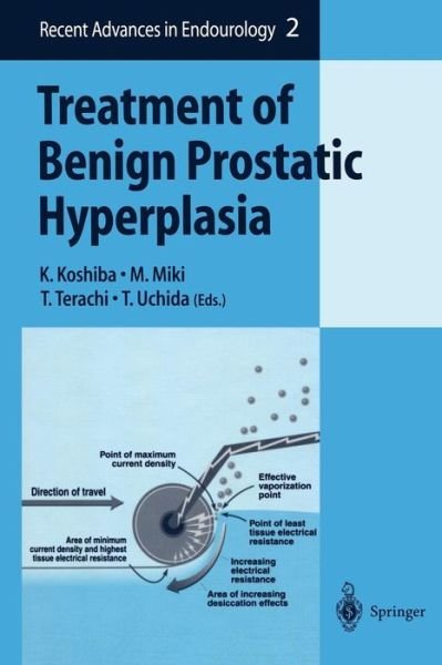 K Koshiba · Treatment of Benign Prostatic Hyperplasia - Recent Advances in Endourology (Paperback Bog) [Softcover reprint of the original 1st ed. 2000 edition] (2012)