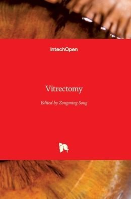 Cover for Zongming Song · Vitrectomy (Gebundenes Buch) (2012)