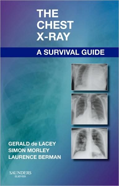 Cover for De Lacey, Gerald, Ma, Frcr (Consultant Radiologist to Www.radiology-courses.com and Formerly Consultant Radiologist at Northwick Park Hospital, London, Uk) · The Chest X-Ray: A Survival Guide (Paperback Book) (2008)