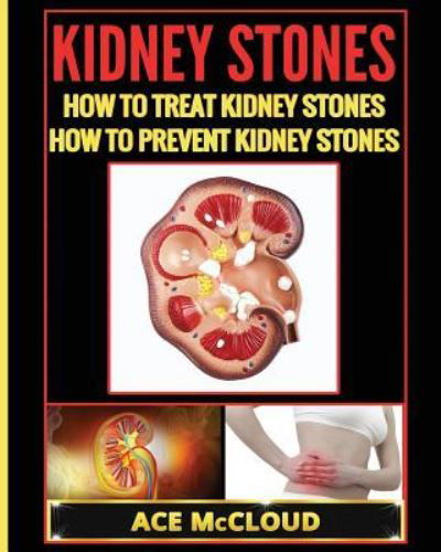 Cover for Ace McCloud · Kidney Stones (Paperback Book) (2017)