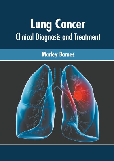 Cover for Marley Barnes · Lung Cancer: Clinical Diagnosis and Treatment (Hardcover bog) (2022)