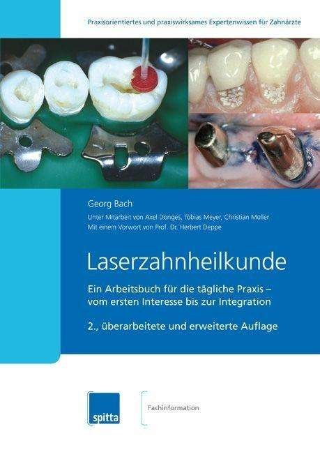 Cover for Bach · Laserzahnheilkunde (Book)