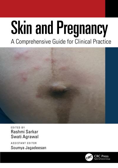 Skin and Pregnancy: A Comprehensive Guide for Clinical Practice (Paperback Book) (2024)