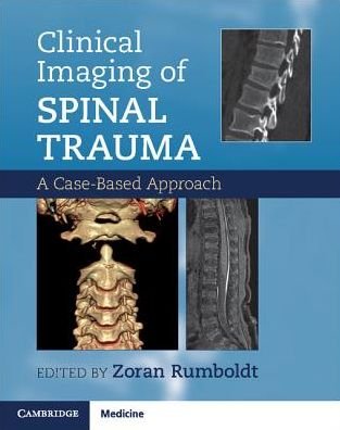 Cover for Zoran Rumboldt · Clinical Imaging of Spinal Trauma: A Case-Based Approach (Taschenbuch) (2018)