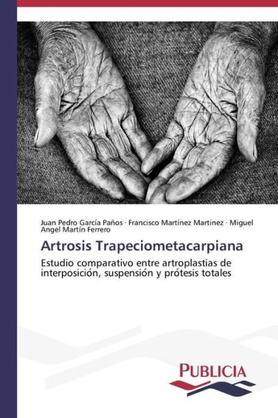 Cover for Miguel Angel Martín Ferrero · Artrosis Trapeciometacarpiana (Paperback Book) [Spanish edition] (2013)