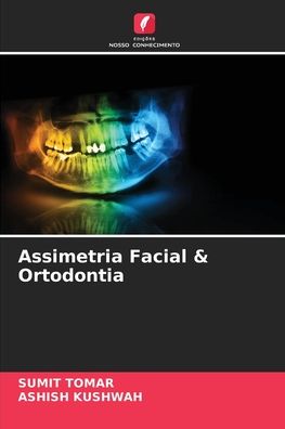 Cover for Sumit Tomar · Assimetria Facial &amp; Ortodontia (Taschenbuch) (2021)