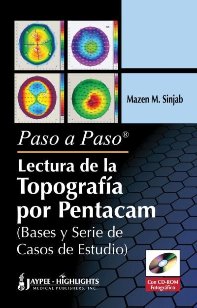 Cover for Mazen M Sinjab · Paso a Paso - Lectura de la Topografia por Pentacam (Innbunden bok) (2012)