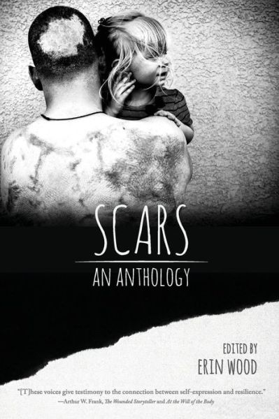 Cover for Erin Wood · Scars: an Anthology (Paperback Book) (2015)