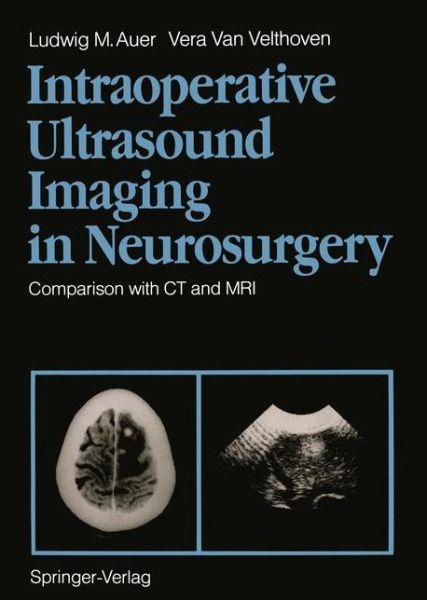 Cover for Ludwig M. Auer · Intraoperative Ultrasound Imaging in Neurosurgery: Comparison with CT and MRI (Paperback Book) [Softcover reprint of the original 1st ed. 1990 edition] (2011)