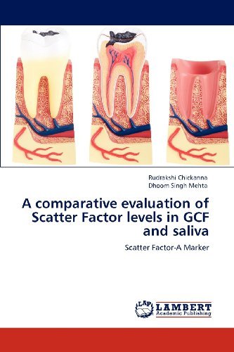 Cover for Dhoom Singh Mehta · A Comparative Evaluation of Scatter Factor Levels in Gcf and Saliva: Scatter Factor-a Marker (Paperback Book) (2012)