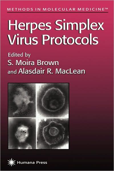 Cover for Peter Brown · Herpes Simplex Virus Protocols - Methods in Molecular Medicine (Innbunden bok) [1998 edition] (1997)
