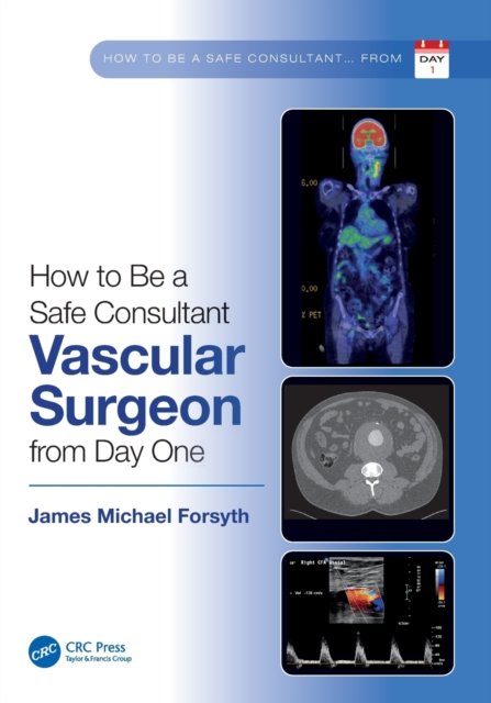 James Forsyth · How to be a Safe Consultant Vascular Surgeon from Day One: The Unofficial Guide to Passing the FRCS (VASC) (Pocketbok) (2022)