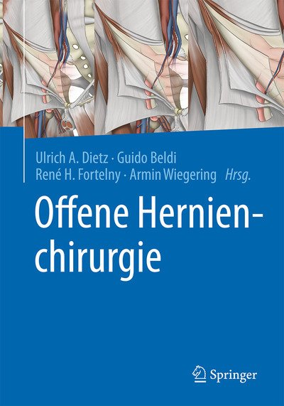 Offene Hernienchirurgie -  - Bøger -  - 9783662613474 - April 6, 2021