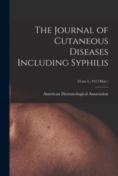 Cover for American Dermatological Association · The Journal of Cutaneous Diseases Including Syphilis; 35 (Paperback Book) (2021)