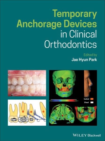 Cover for JH Park · Temporary Anchorage Devices in Clinical Orthodontics (Innbunden bok) (2020)