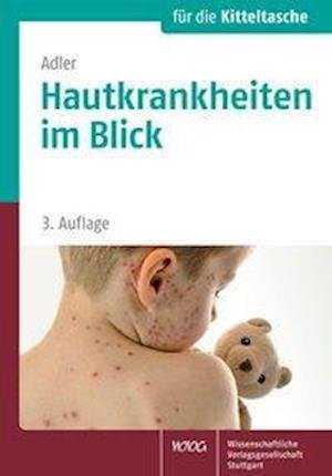 Hautkrankheiten im Blick - Adler - Bücher -  - 9783804732476 - 