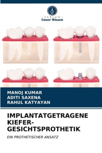 Implantatgetragene Kiefer-gesicht - Kumar - Other -  - 9786203402476 - March 10, 2021