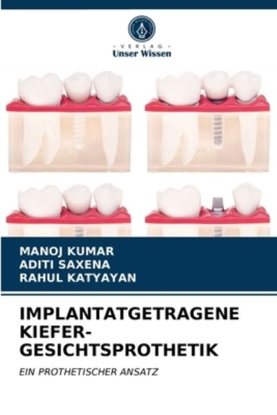 Implantatgetragene Kiefer-gesicht - Kumar - Other - - 9786203402476 - March 10, 2021