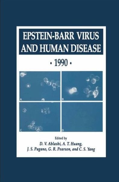 Cover for D V Ablashi · Epstein-Barr Virus and Human Disease * 1990 - Experimental Biology and Medicine (Paperback Book) [Softcover reprint of the original 1st ed. 1991 edition] (2012)