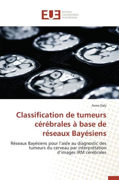 Cover for Daly Asma · Classification De Tumeurs Cerebrales a Base De Reseaux Bayesiens (Paperback Book) (2018)