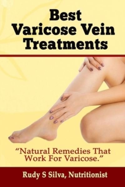 Cover for Rudy Silva Silva · Best Varicose Vein Treatments: Natural Remedies That Work for Varicose (Paperback Bog) (2013)
