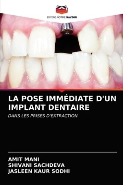 Cover for Mani · La Pose Immédiate D'un Implant den (N/A) (2021)