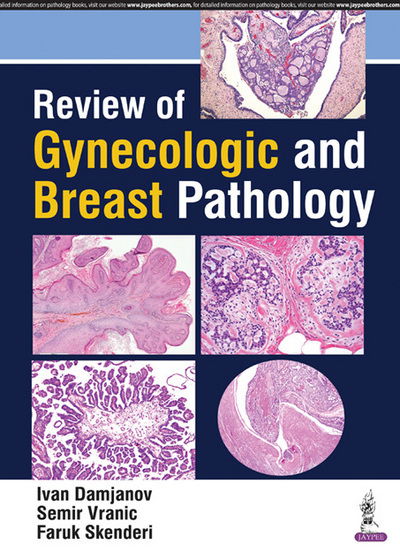 Cover for Ivan Damjanov · Review of Gynecologic and Breast Pathology (Taschenbuch) (2017)