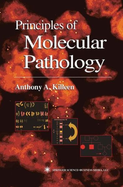 Cover for Anthony Killeen · Principles of Molecular Pathology (Paperback Book) [1st ed. Softcover of orig. ed. 2004 edition] (2010)