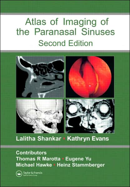 Cover for Lalitha Shankar · Atlas of Imaging of the Paranasal Sinuses, Second Edition (Hardcover Book) (2006)