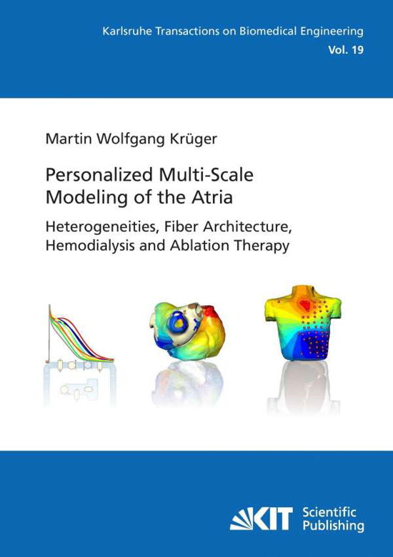 Cover for Krüger · Personalized Multi-Scale Modelin (Bog) (2014)