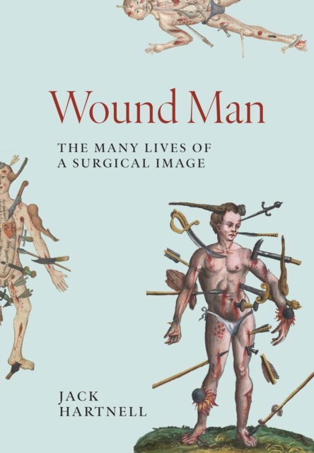 Cover for Jack Hartnell · Wound Man: The Many Lives of a Surgical Image (Hardcover Book) (2025)