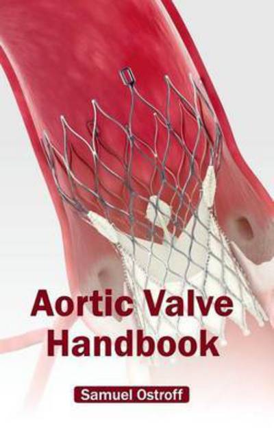 Cover for Samuel Ostroff · Aortic Valve Handbook (Hardcover Book) (2015)