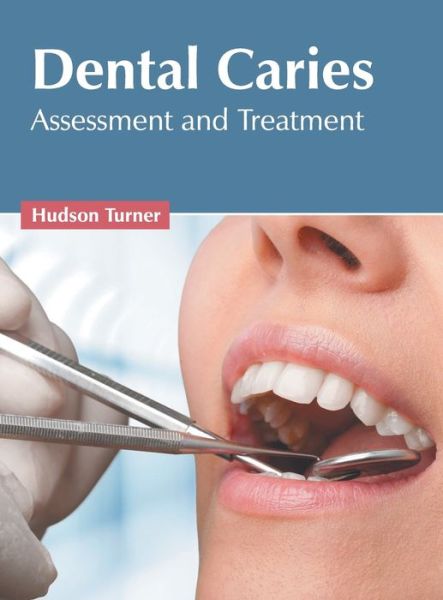 Hudson Turner · Dental Caries: Assessment and Treatment (Inbunden Bok) (2022)