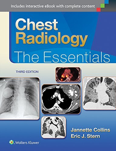 Cover for Janette Collins · Chest Radiology: The Essentials - Essentials Series (Hardcover Book) (2014)