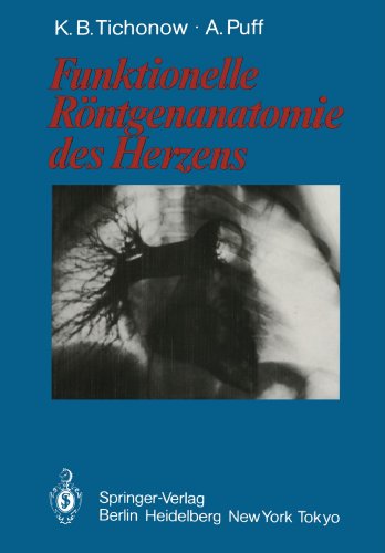 Cover for Konstantin B. Tichonow · Funktionelle Rontgenanatomie Des Herzens (Paperback Book) [Softcover reprint of the original 1st ed. 1986 edition] (2011)