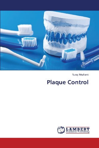 Cover for Suraj Multani · Plaque Control (Paperback Book) (2013)